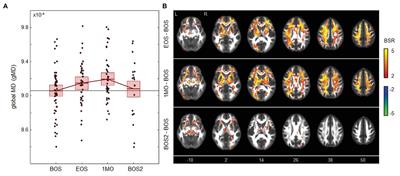 Disturbances in Brain Physiology Due to Season Play: A Multi-Sport Study of Male and Female University Athletes